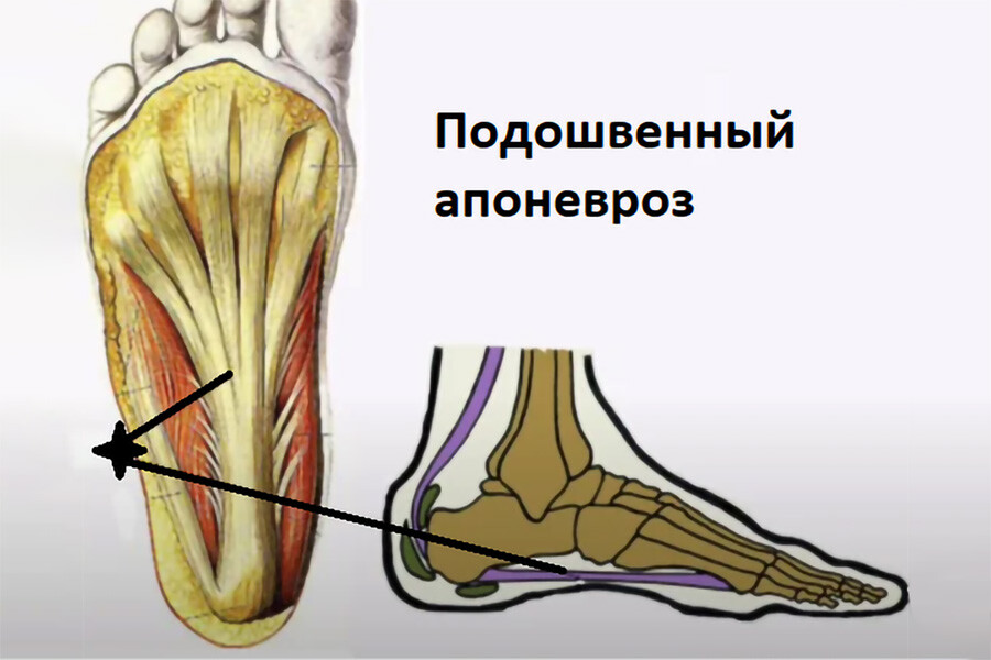 Подошвенный апоневроз Подошвенный апоневроз