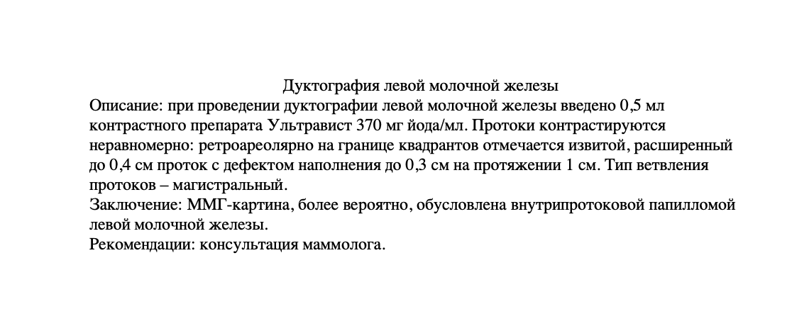 Дуктография - пример протокола Дуктография - пример протокола