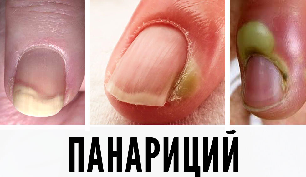 <p> Вебинар для мастеров маникюра и педикюра. </p> <p> Вебинар для мастеров маникюра и педикюра. </p>