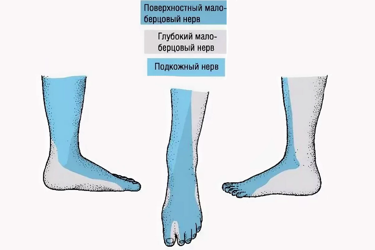 Слабость и неустойчивость стоп. Туннельный синдром малоберцового нерва ...