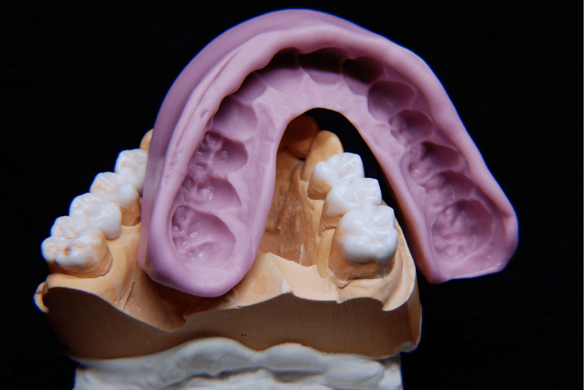 Зубной техник. Восковое моделирование.