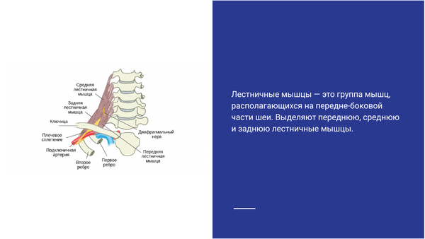 Синдром лестничной мышцы Синдром лестничной мышцы