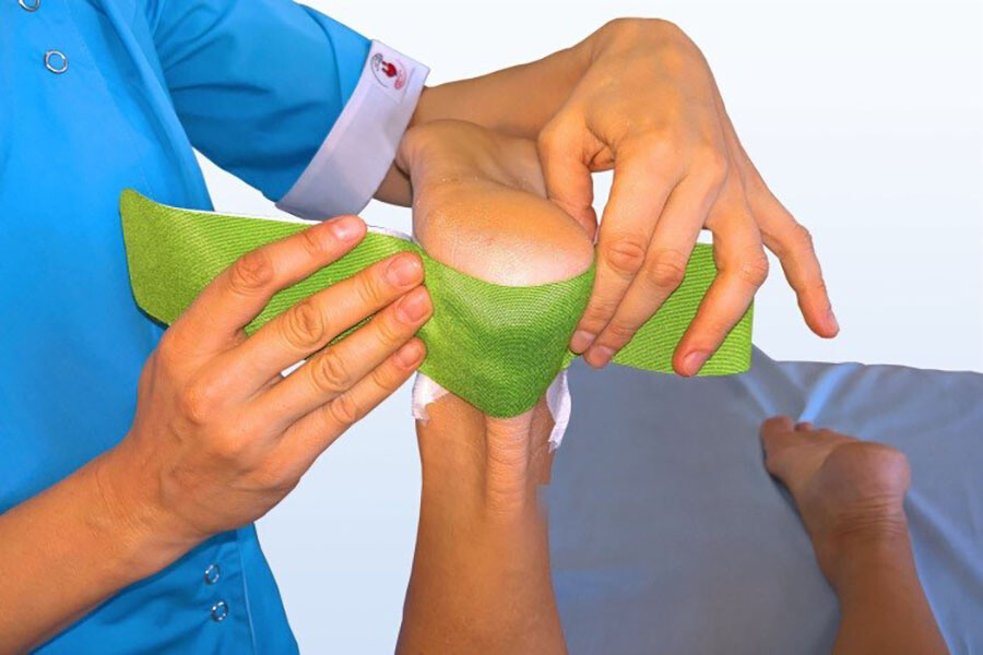 Тейпирование голеностопного сустава - наклеивание эластичного тейпа от 1 до 5 плюснефалангового сустава
