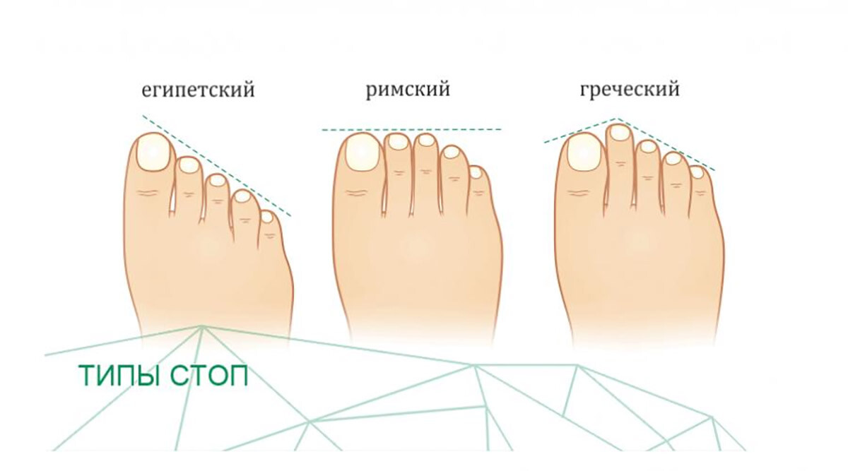 Типы стоп