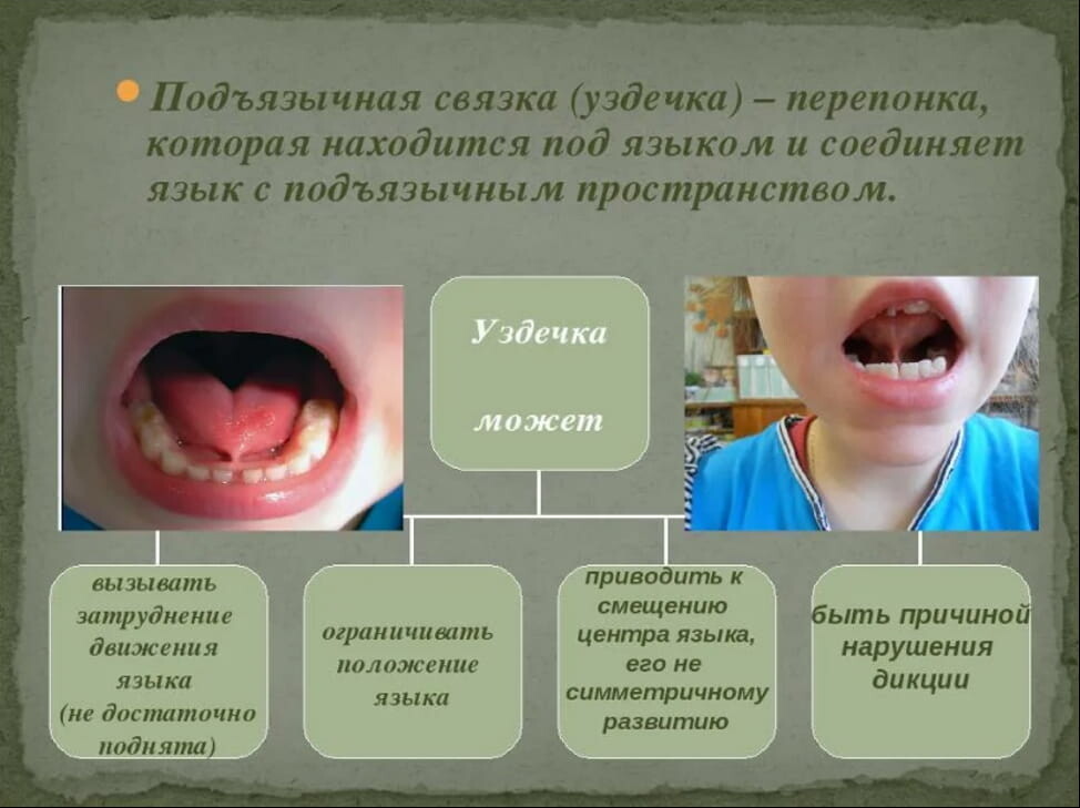 Язык мой – друг мой: как растянуть язык?