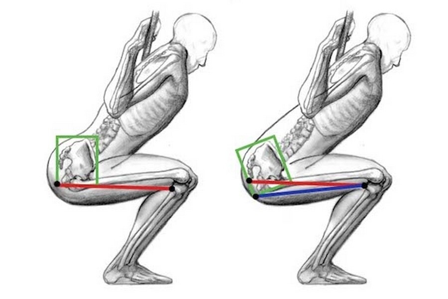 Болят ноги при подъеме по лестнице. Приседания анатомия. Упражнения для спины сидя. Тазодоминантные приседания. Приседания биомеханика без штанги.