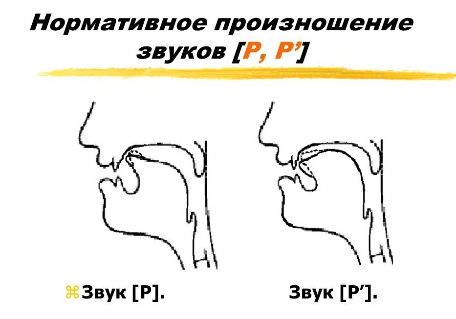 Приемы постановки нарушенных звуков. Часть 3. Блог Лого Портал