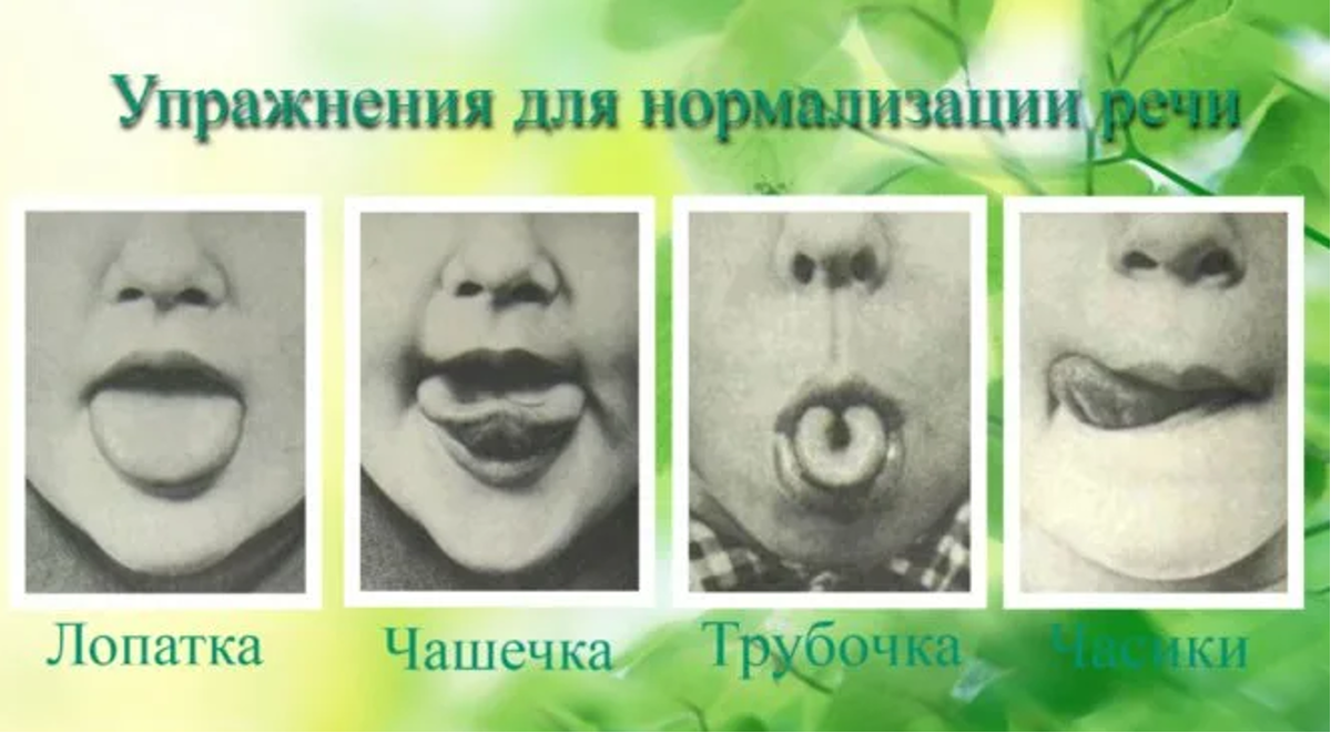 Реабилитация и восстановление речи после инсульта, логопед Российские ученые разрабатывают приложение для восстановления речи после инсульта