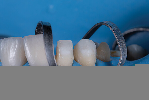 <p>
		Рис. 11</p>