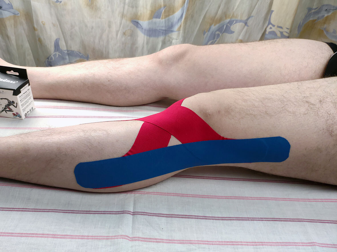 Фото 9. Тейпирование для стабилизации коллатеральный связок коленного сустава - наклеивание первого отрезка тейпа часть 2