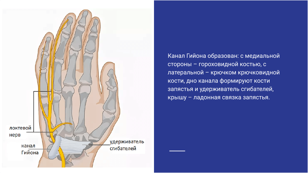 Каналы запястья. Гийонов канал анатомия. Туннельные синдромы Гюйона. Запястный канал и канал Гюйона.