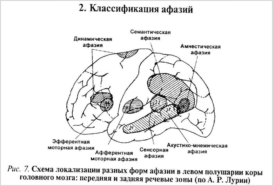 Афазия - симптомы, причины, диагностика и лечение. Блог Лого Портал