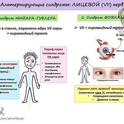 Альтернирующие синдромы презентация