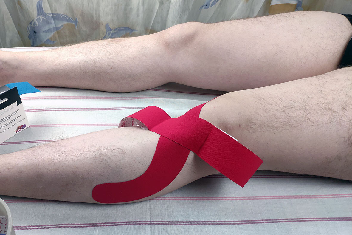 Тейпирование колена бегуна