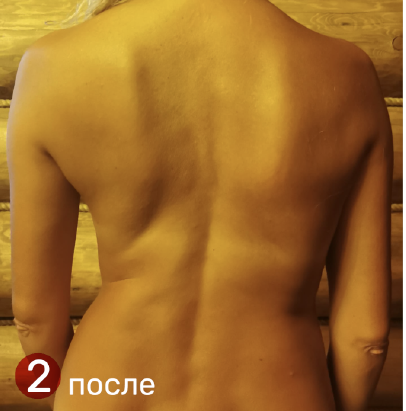 
		<p><br></p><p>		<strong>ПОСЛЕ&nbsp;</strong></p><p><strong>дистанционной терапии (3 сеанса)</strong>	</p>	