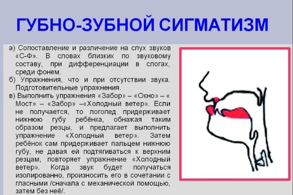 Нарушение артикуляционных схем отдельных звуков является первичным дефектом при