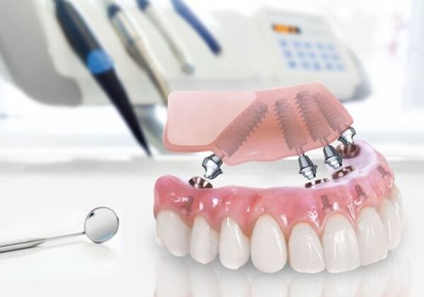 бесплатное изготовление и ремонт зубных протезов