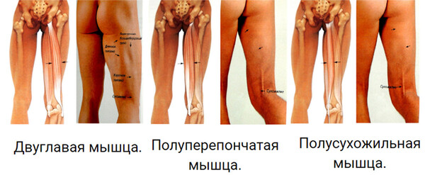 Что такое сколиоз? Причины, симптомы и методы лечения