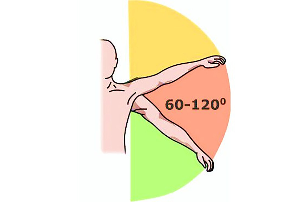 Болезненная дуга отведения руки при повреждении сухожилий вращательной манжеты плечевого сустава