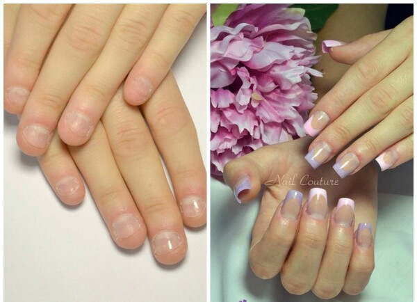 Sculpting perfect shape on nail biter's nails. Blog records Sculpting perfect shape on nail biter's nails. Blog records