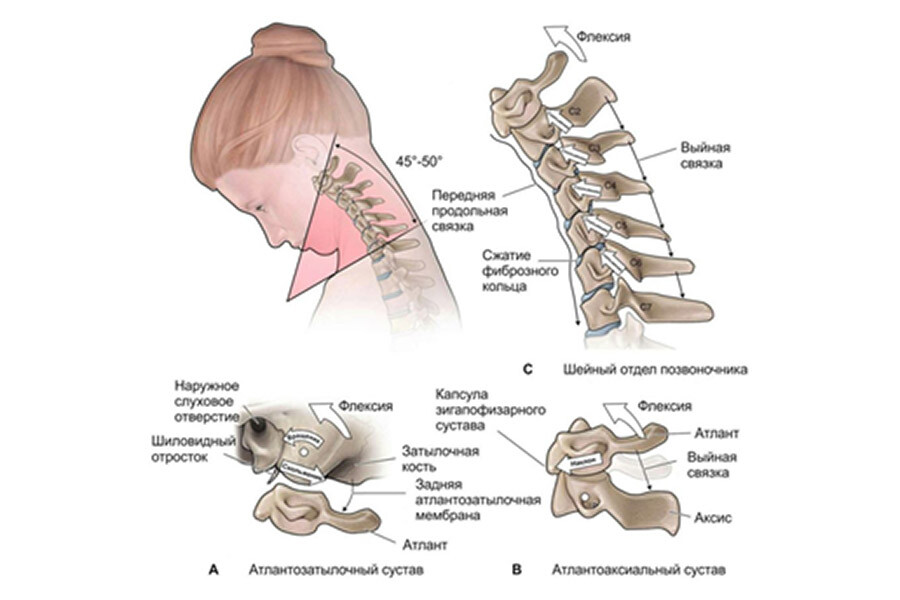 Лечение шейного отдела позвоночника