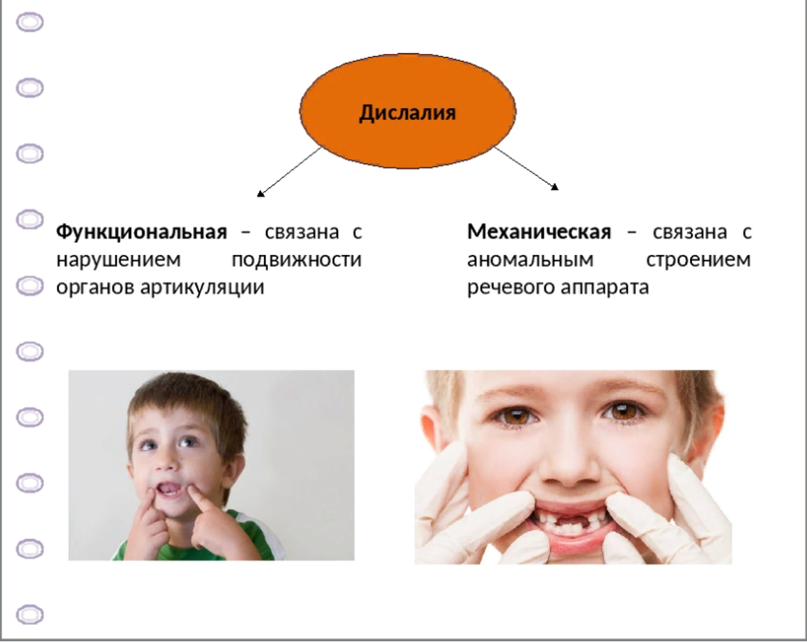 Функциональная моторная дислалия обусловлена