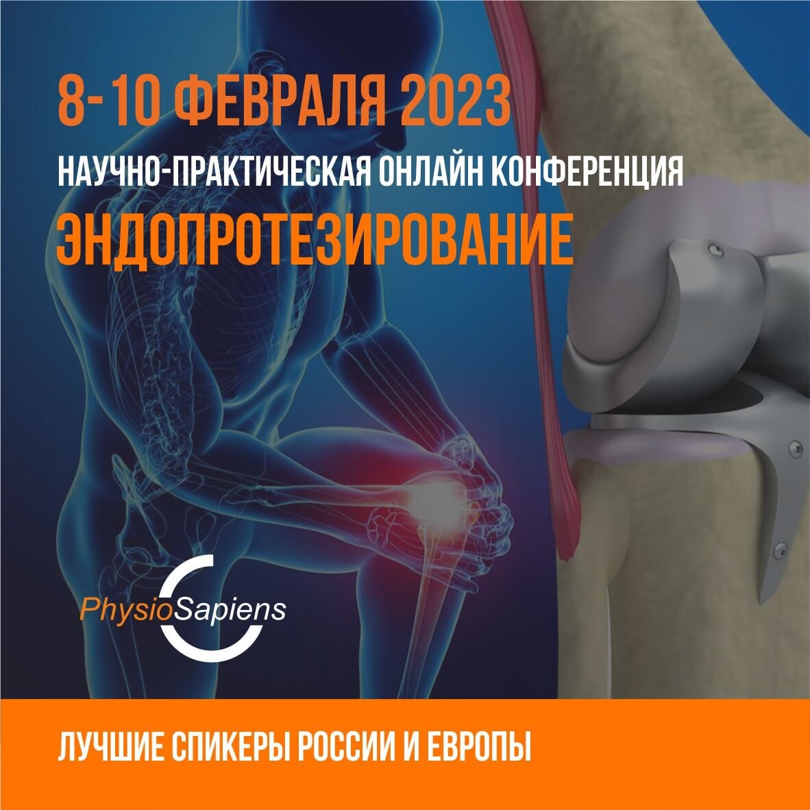 Артроклуб
