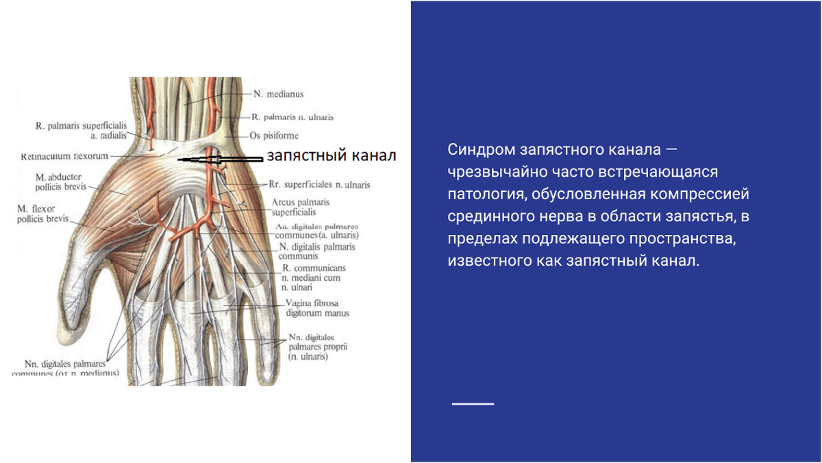 Синдром карпального канала мкб 10. Синдром карпального канала кисти. Карпальный канал кисти анатомия. Карпальный канал запястья. Срединный нерв карпального канала.