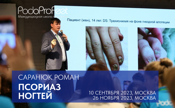 Псориаз ногтей