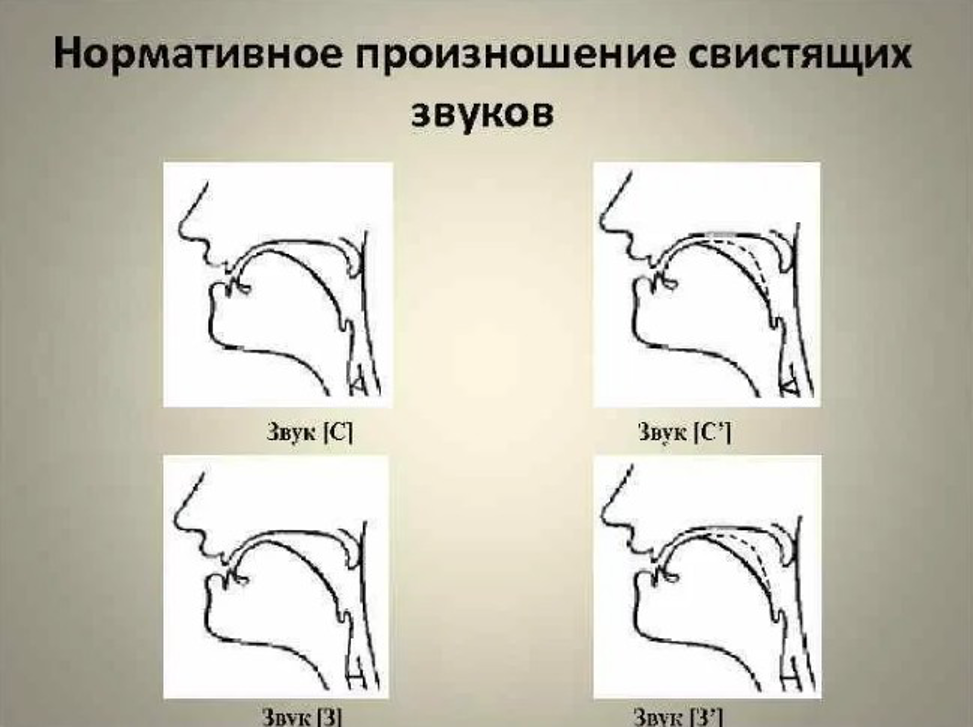 Профили артикуляции свистящих звуков. Артикуляционный профиль звуков при ринолалии. Профили артикуляции свистящих звуков при ринолалии. Нарисуйте профили артикуляции свистящих звуков.. З артикуляция