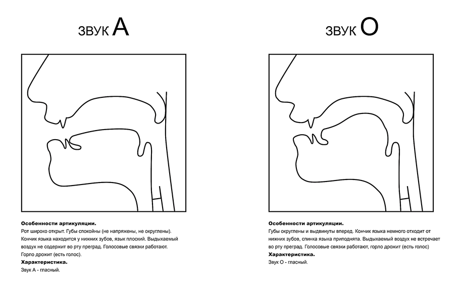 Угадай профиль. Артикуляционные профили гласных звуков при ринолалии. Новикова артикуляция звуков в графическом изображении. Артикуляционный профиль звуков в логопедии. Артикуляционный уклад звуков в норме.