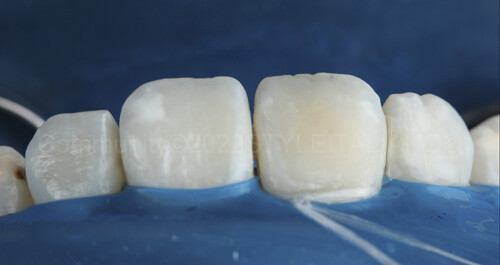 
		<p>
		Рис. 12</p>	