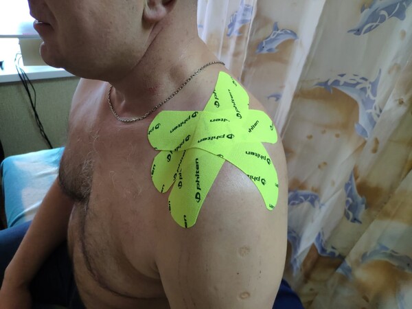 Лечение боли в плече. Повреждение АКС. Поражение капсулы плечевого ...